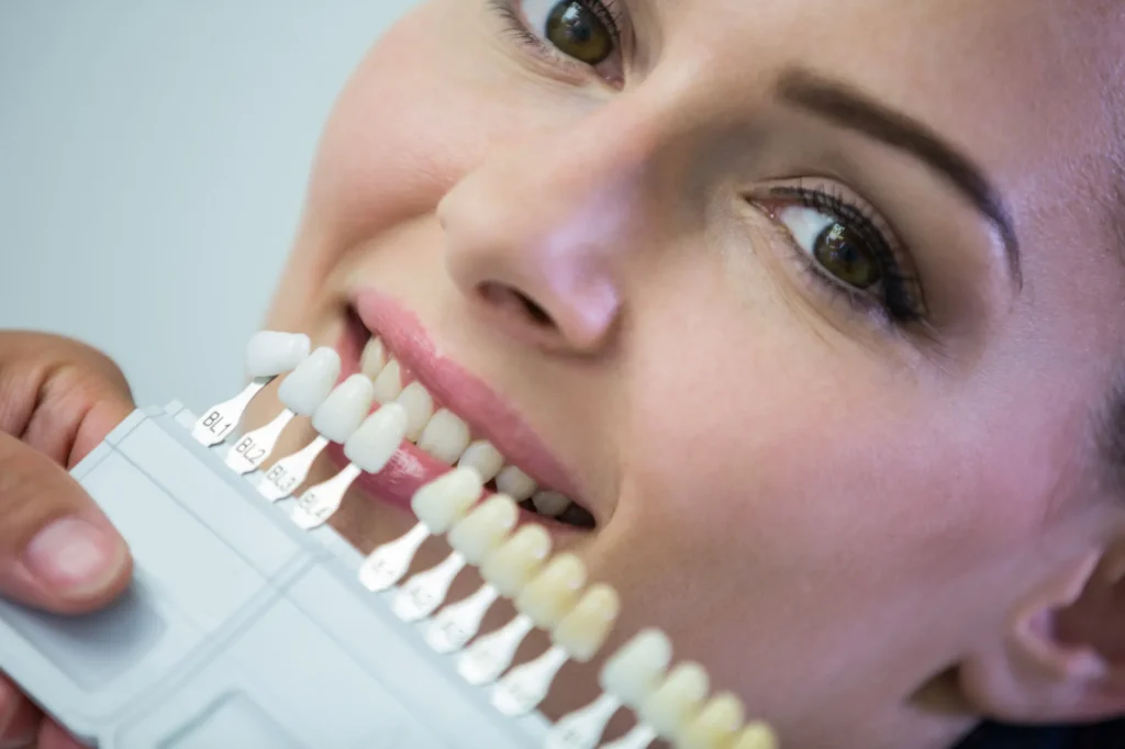 Costo De Los Implantes Dentales Estéticos