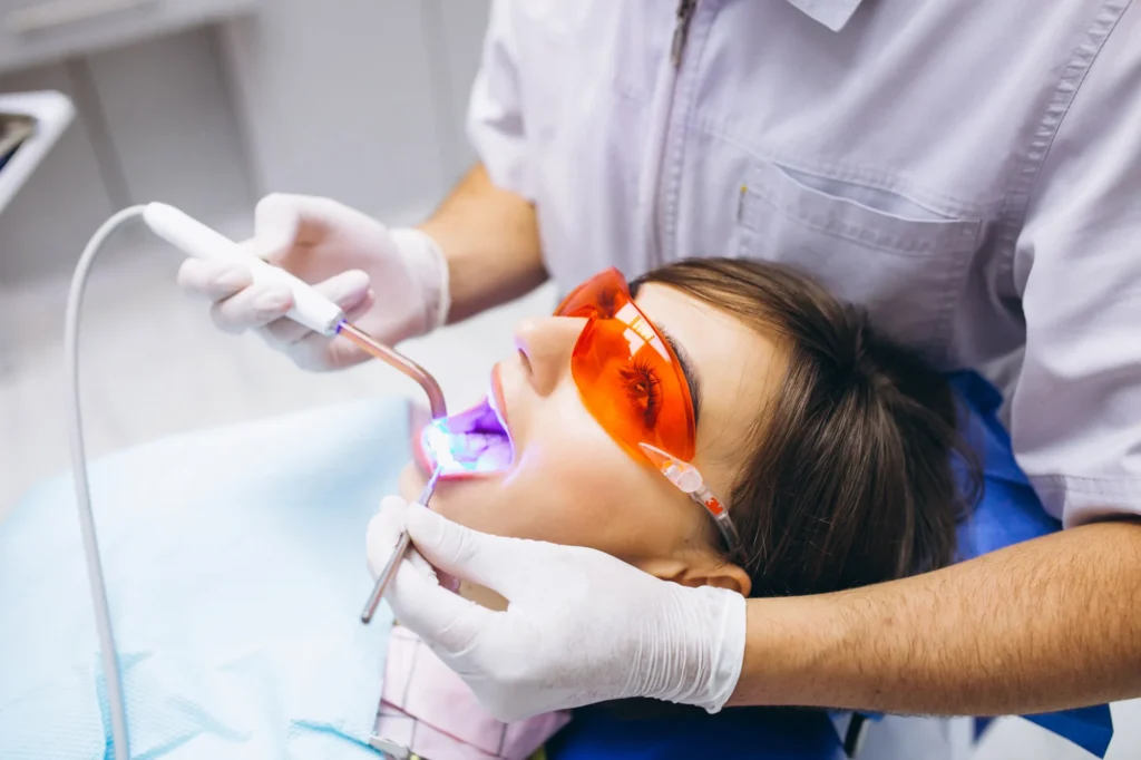 Alternativas al blanqueamiento dental