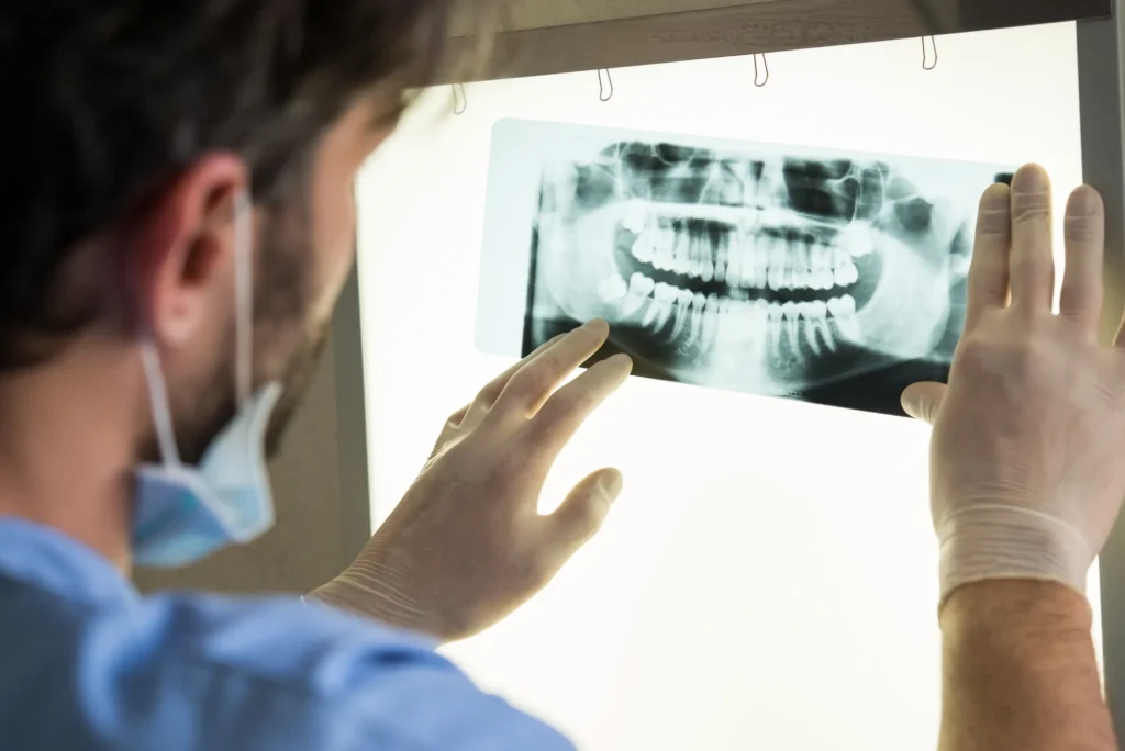 Beneficios de las radiografías dentales