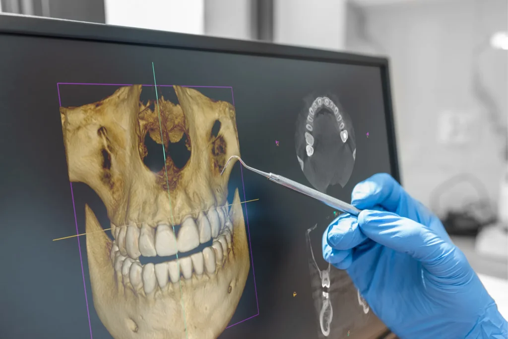 Importancia de la tomografía dental