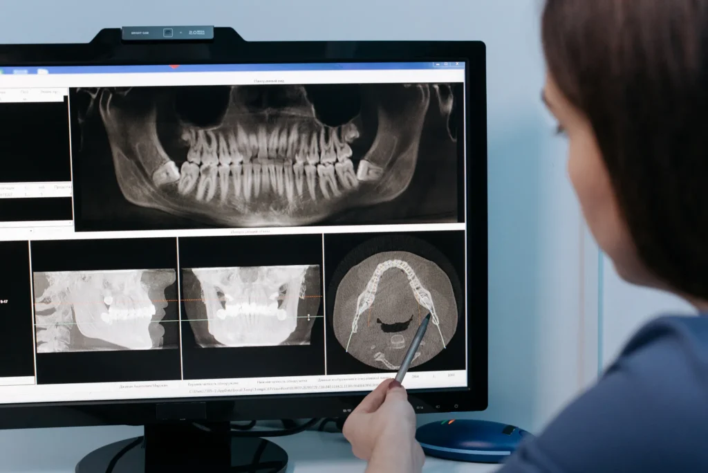 Tipos de radiografías utilizadas en odontología